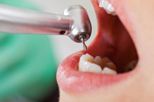 Best Cracked Tooth Emergency Dentist  in Germantown, TN
